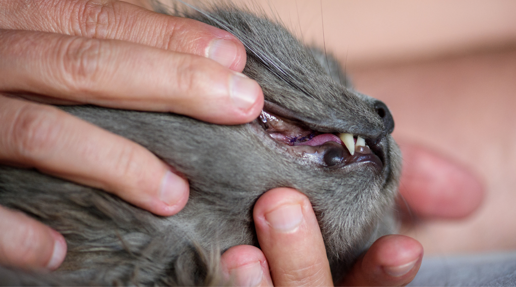 Epulisul - pseudotumora inflamatorie a gingiilor