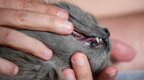 Epulisul - pseudotumora inflamatorie a gingiilor